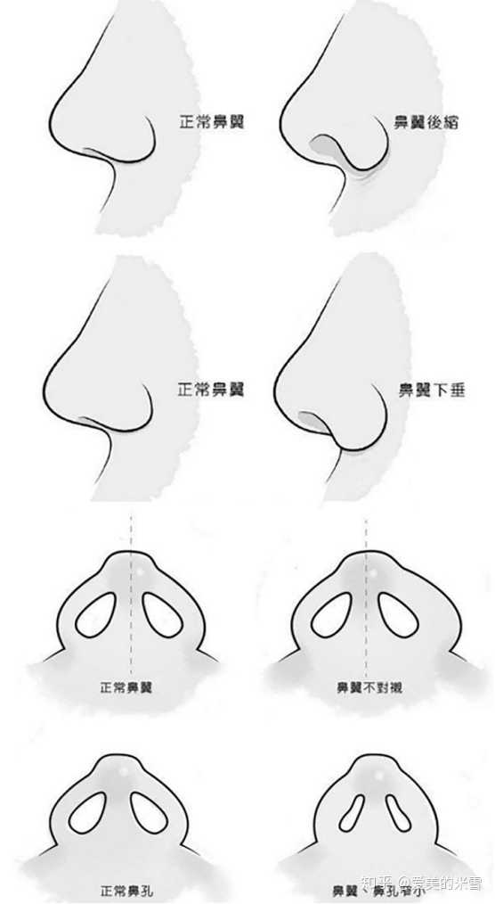 什么样的鼻子好看？