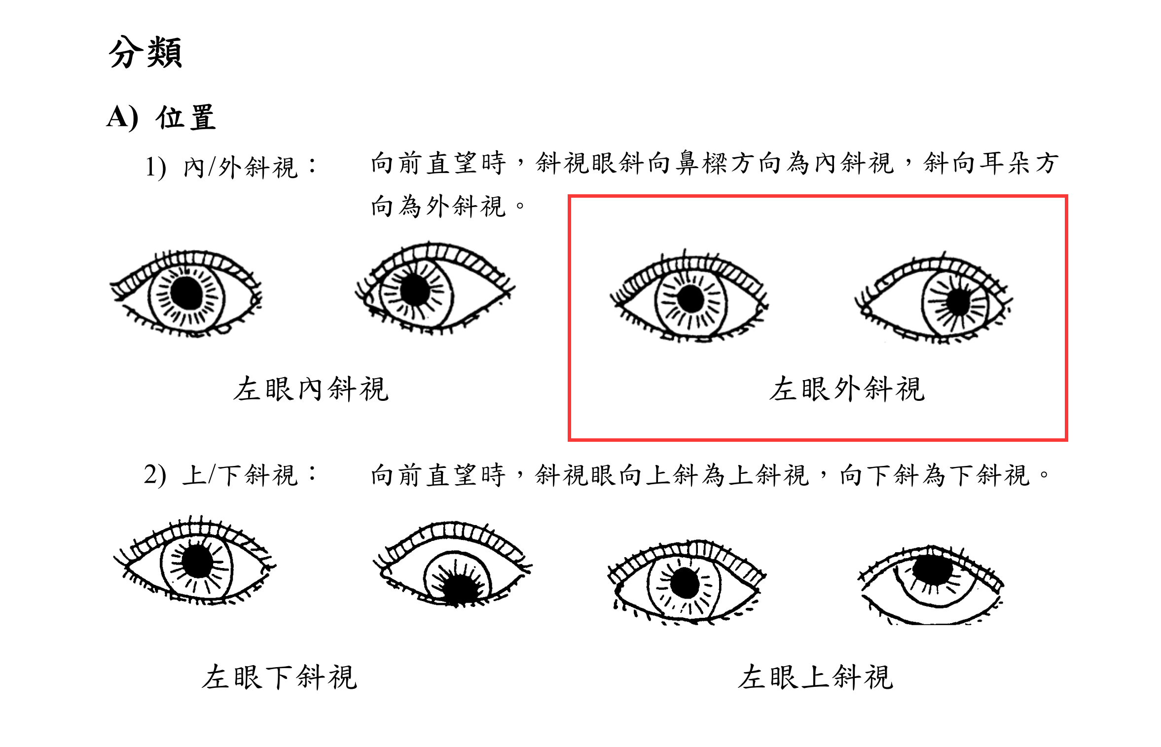 斜视图的作用图片