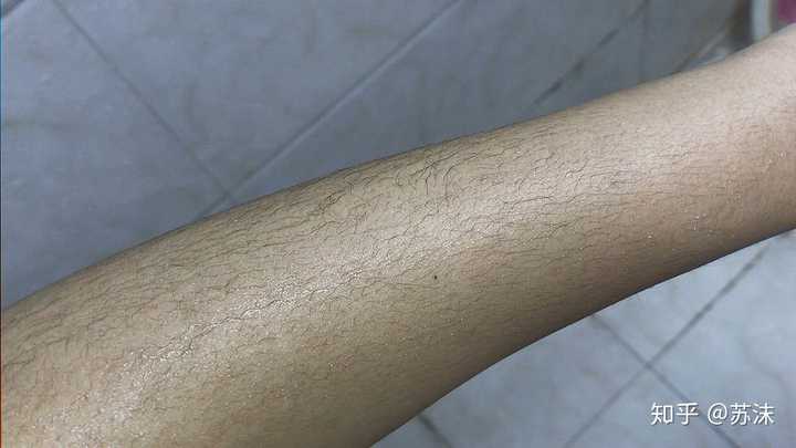 汗毛会越刮越重吗?
