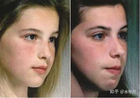 为什么晚上睡觉总用嘴巴呼吸 有什么危害吗 如何避免 知乎 为什么晚上睡觉总用嘴巴呼吸 有什么危害吗 如何避免 知乎