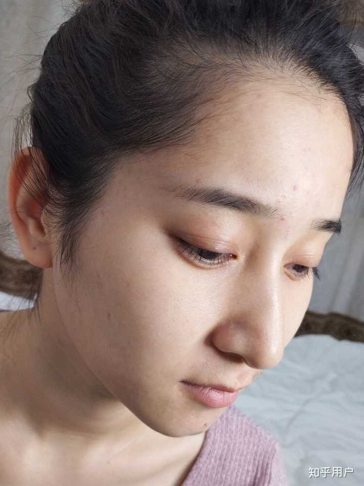 怎么养出好皮肤 知乎 怎么养出好皮肤 知乎