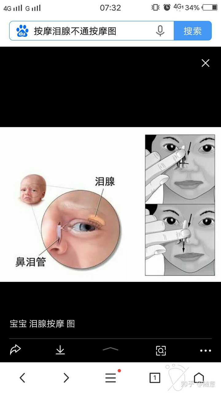 婴儿泪腺图片
