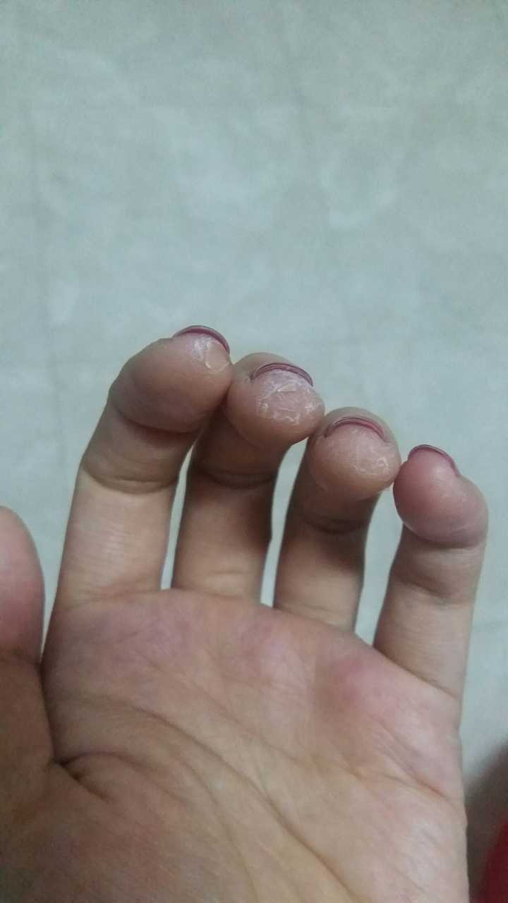 磨出一手茧子 再悄咪咪地传个图.