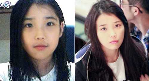 国民妹妹iu整过容吗 疙瘩姐的回答 知乎