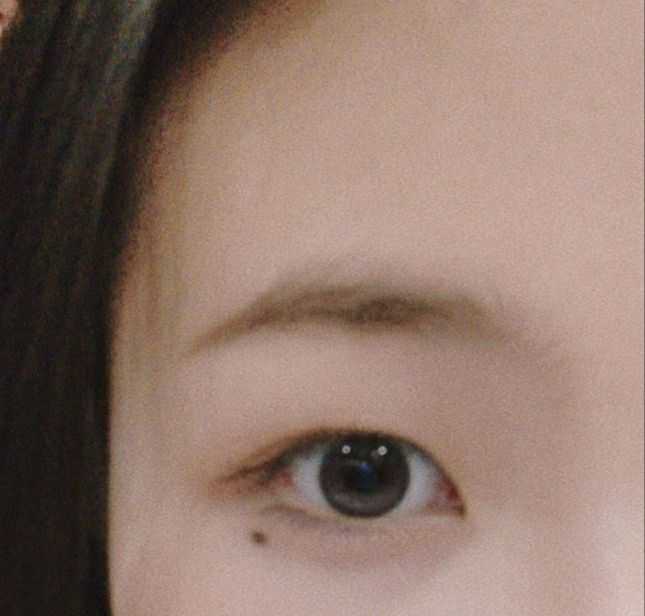 为什么老是有人劝我把眼角的痣给点了?