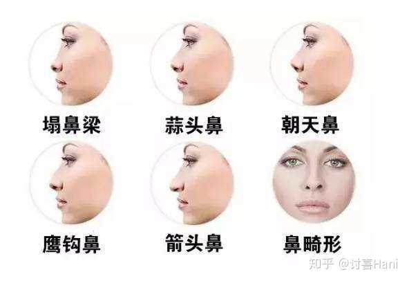 塌鼻梁女生一定不好看吗 知乎