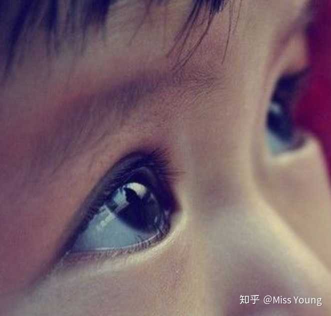 眼白为什么越来越浑浊 越来越黄 有什么方法让眼白白亮起来呢 知乎 眼白为什么越来越浑浊 越来越黄 有什么方法让眼白白亮起来呢 知乎