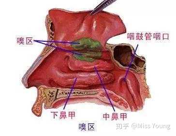 鼻炎的危害到底有多大 知乎