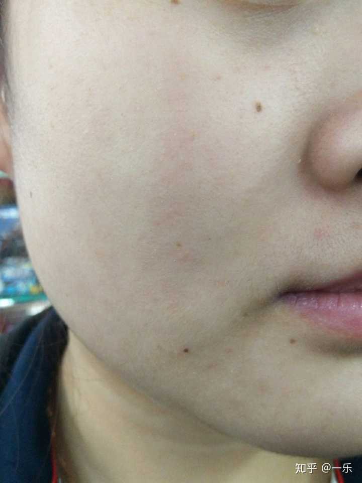 角质层薄的人该怎么护肤?