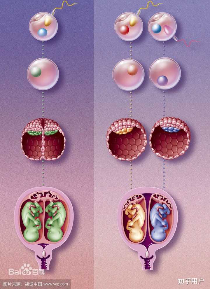 有没有可能两个精子同时进入一个卵细胞（包括特殊情况）？同卵双生什么情况下是异性？ - 知乎