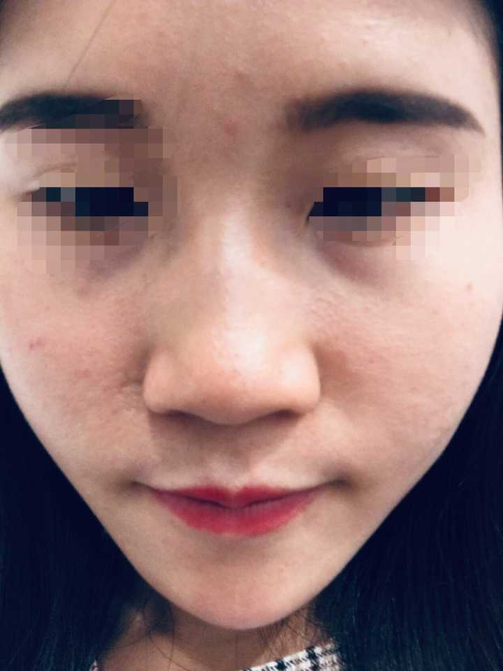 鼻子大真的很难看吗?