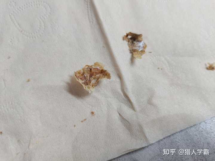 耳屎能大到什么程度？