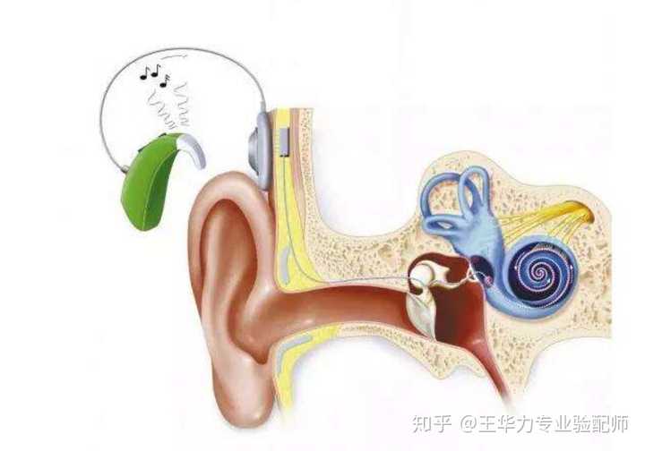 仍然需要利用外耳道,鼓膜,听骨链和耳蜗内残余毛细胞及神经通路传递