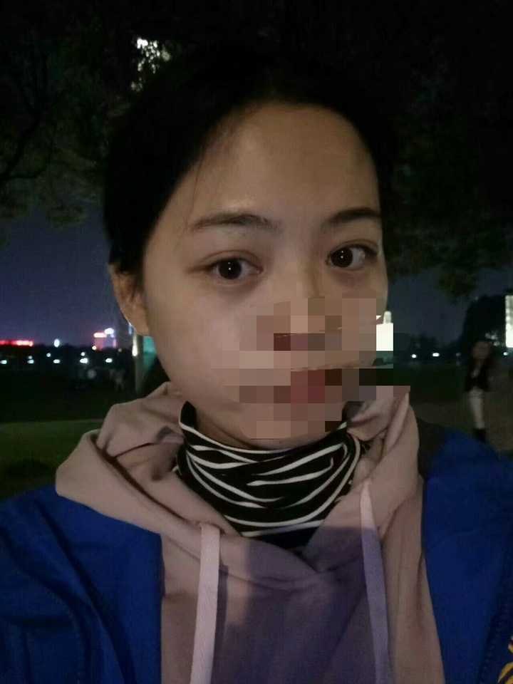 三年我的眼睛真的变大惹,没有什么科学依据可素事实奏是酱 有图有真相