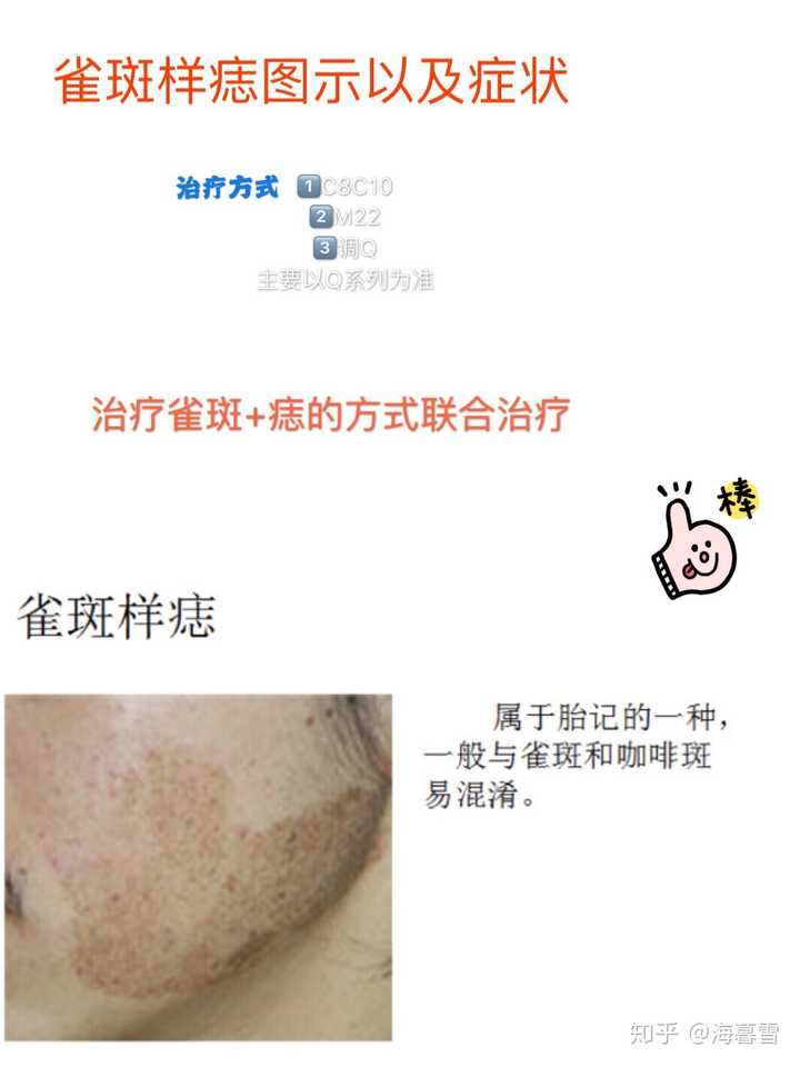 雀斑样痣和雀斑的区别哪种比较容易根治 知乎 雀斑样痣和雀斑的区别哪种比较容易根治 知乎