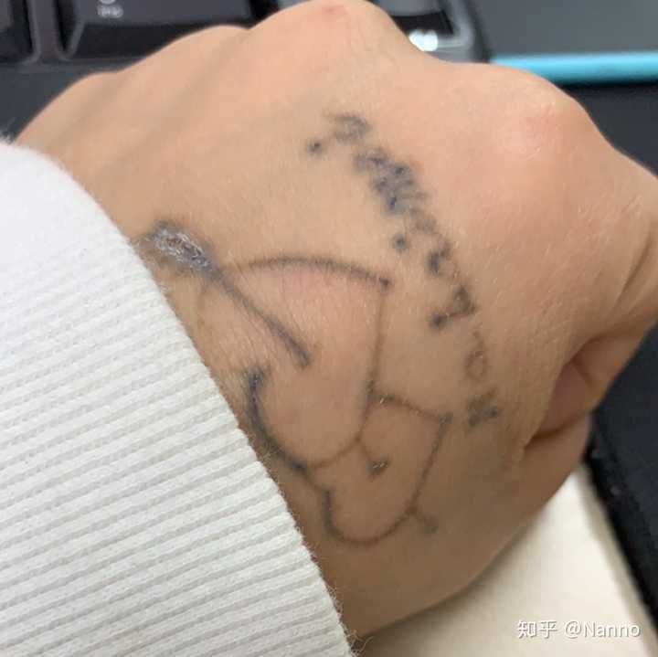 纹身部位还能激光脱毛么 知乎 纹身部位还能激光脱毛么 知乎