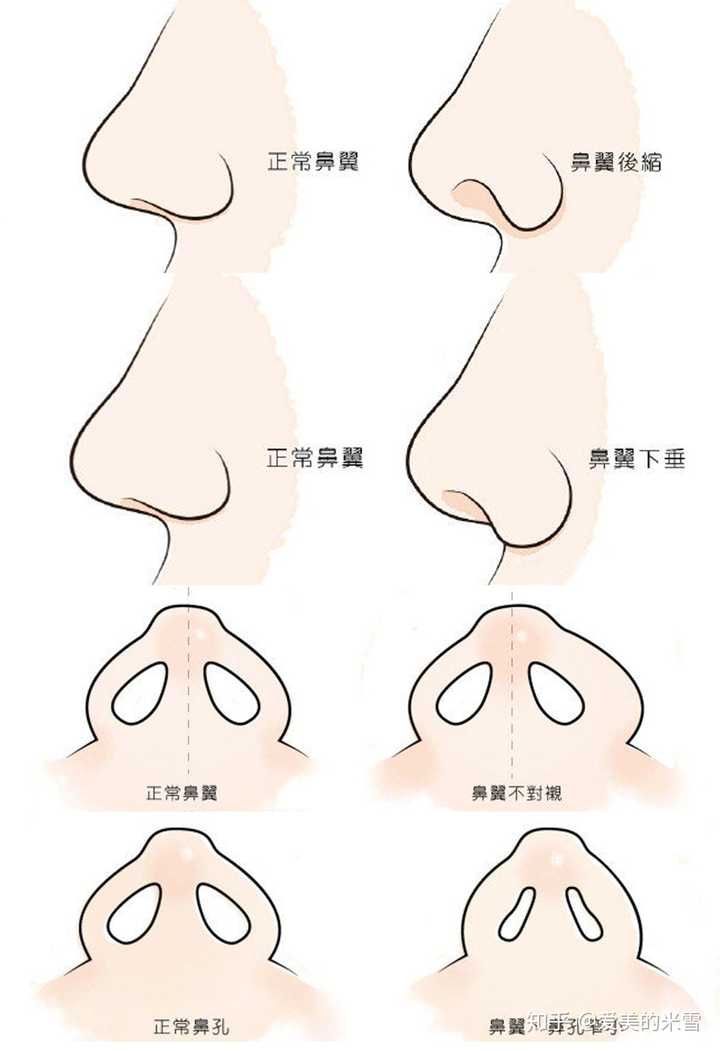 为什么鼻子丑的人无法好看？