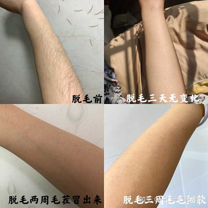 脱毛膏对身体的危害有多大 知乎 脱毛膏对身体的危害有多大 知乎