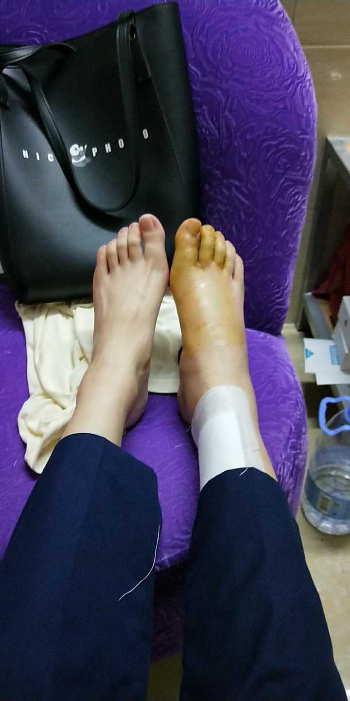 轿车撞我电动车理赔问题?