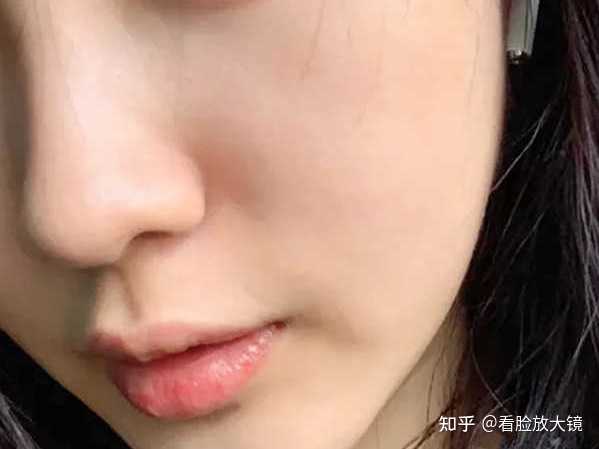 怎样可以祛黑头 知乎 怎样可以祛黑头 知乎