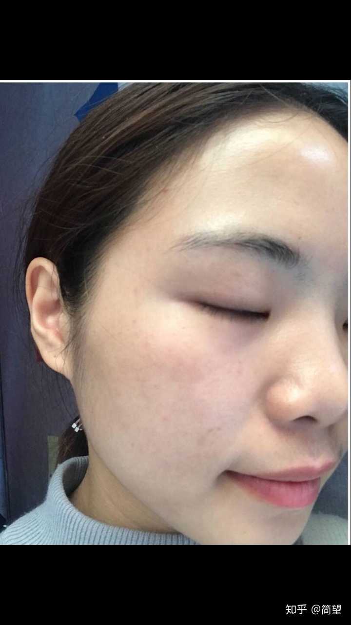 如何才能让皮肤细腻无暇?