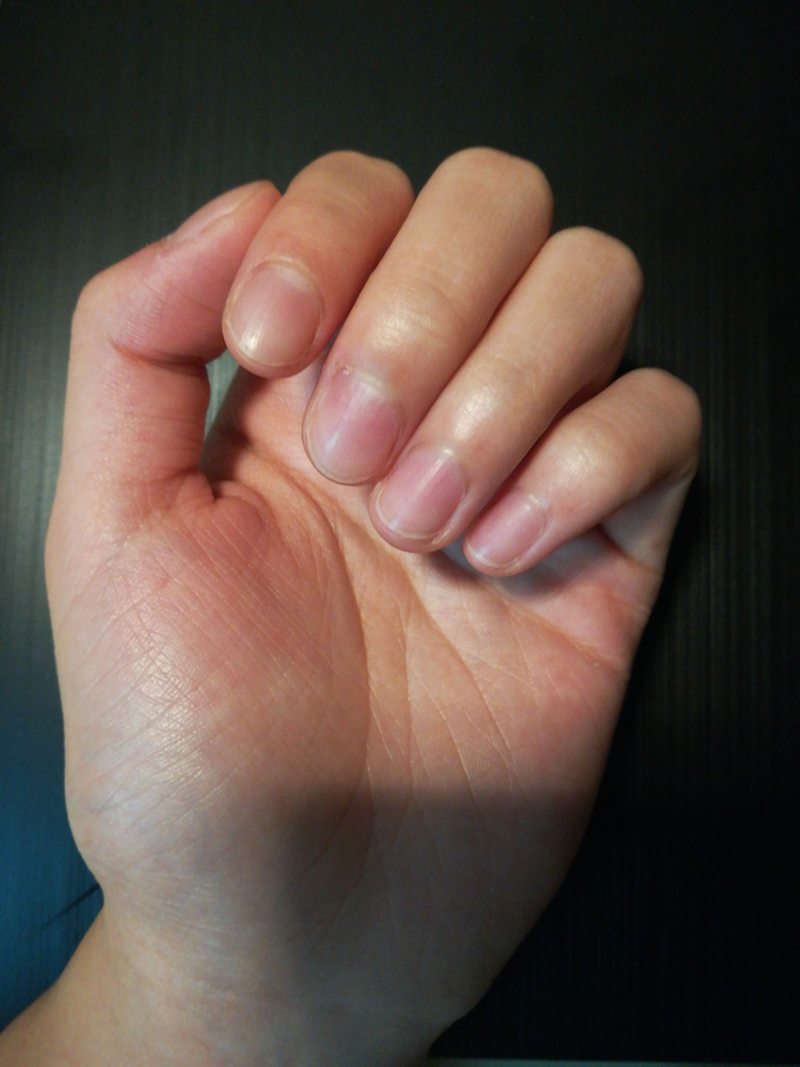 食指中指指甲盖长度养的差不多了,无名指小拇指还是可以看出来以前咬