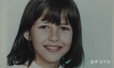 为什么非常多的明星都有斜视而不去治疗 知乎