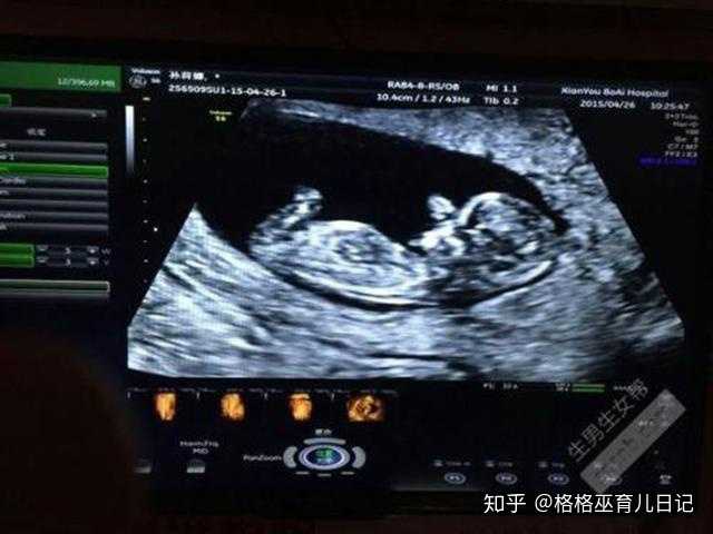 怀孕几个月b超能差出男女 知乎 怀孕几个月b超能差出男女 知乎