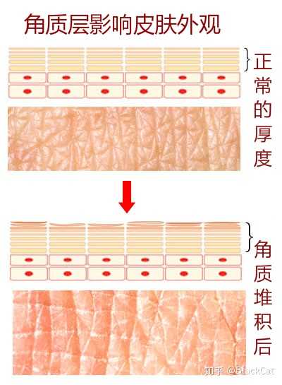 再来了解什么是角质层?