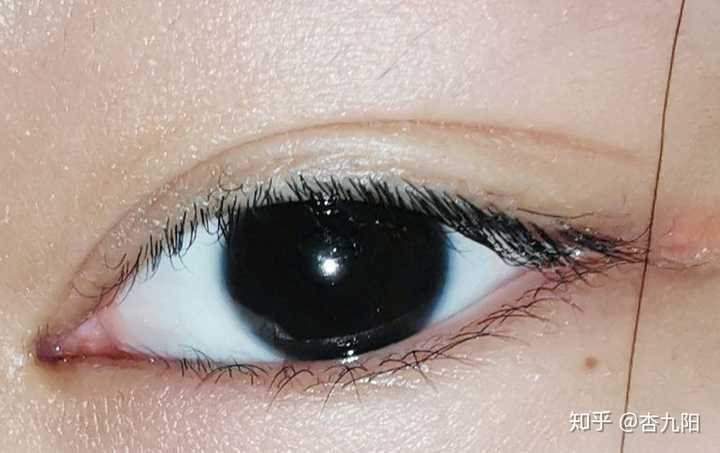 拥有不寻常的虹膜是种怎样的体验?