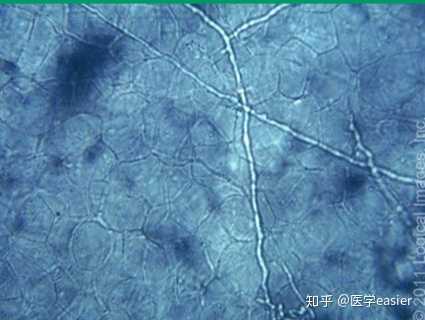 老一辈人说 脚气在土里走走就好了 有什么科学道理吗 医学easier 的回答 知乎