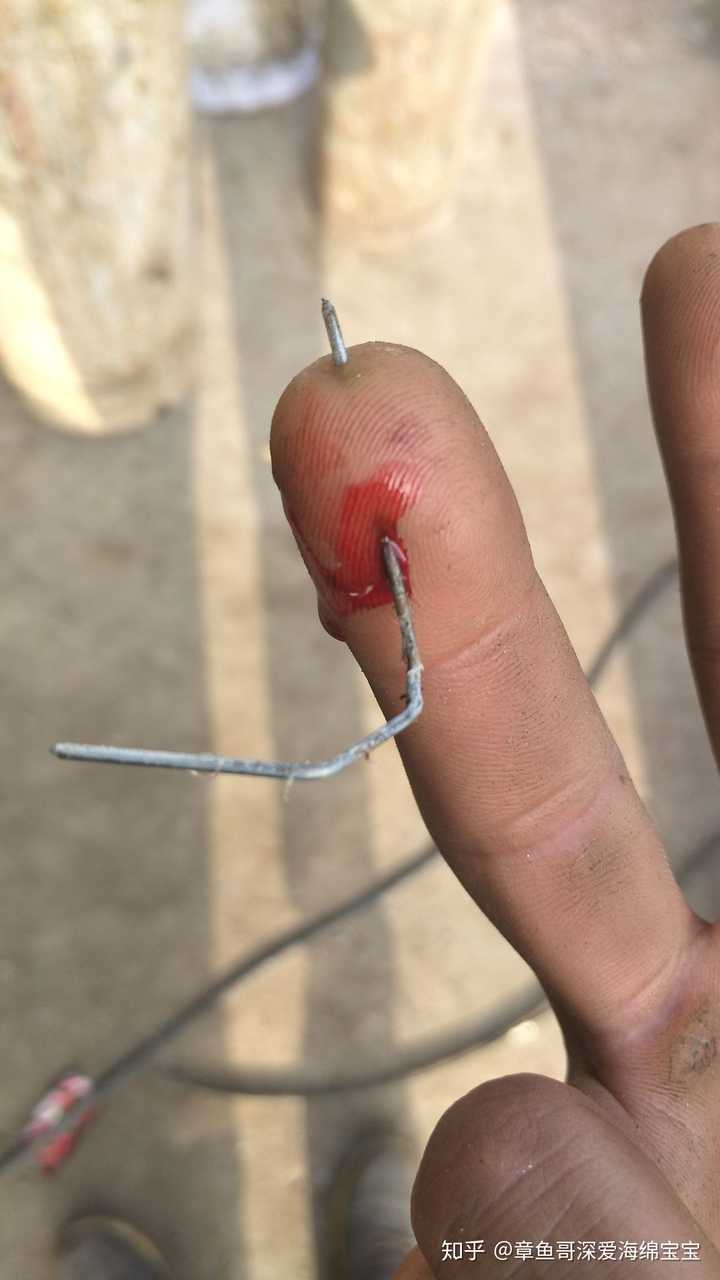 你见过哪些看着就疼的操作?