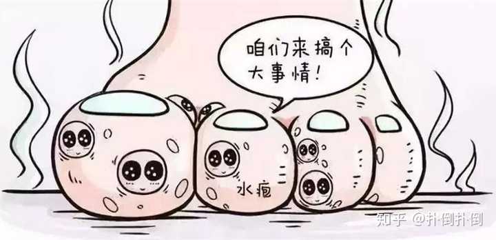 你们的水泡型脚气是怎么治好的?求分享经验?