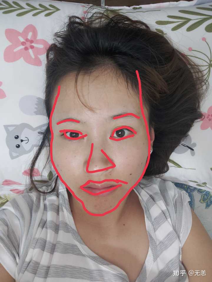 左右脸不对称怎么办？（带图）？