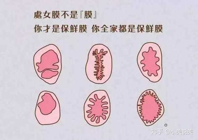最近我在想我要不要去修补处女膜?