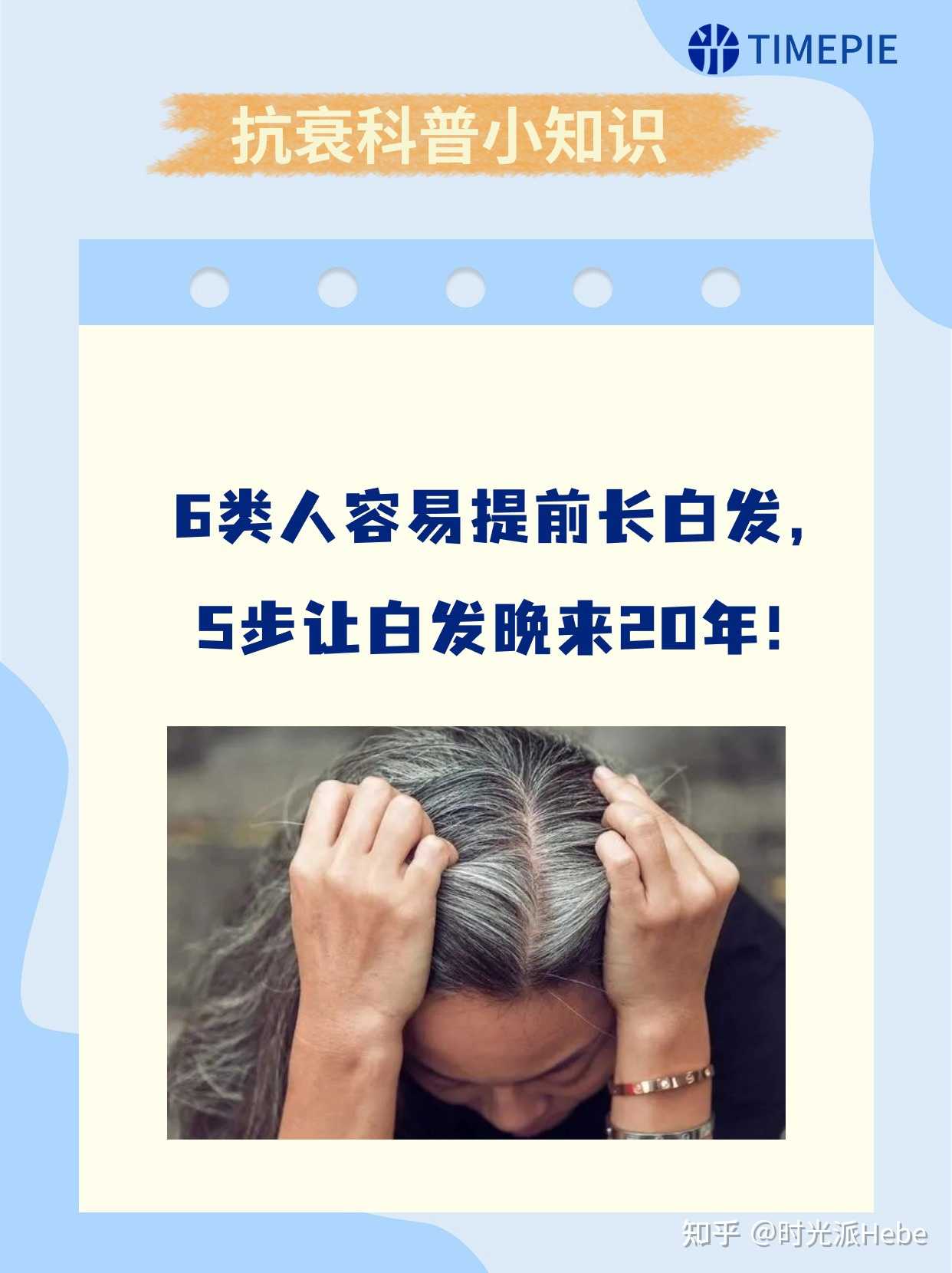 少白头