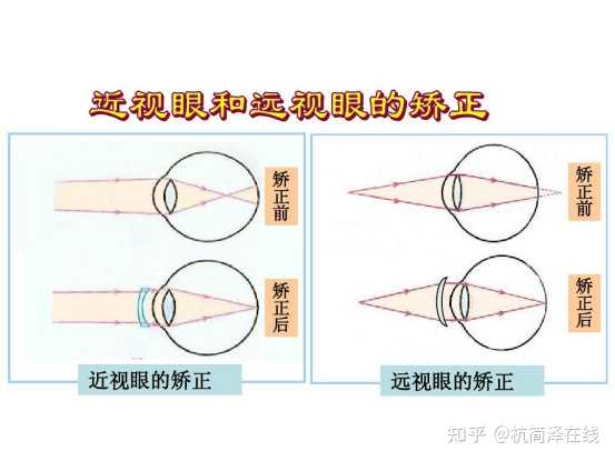 做近视眼手术到底好不好 知乎 做近视眼手术到底好不好 知乎