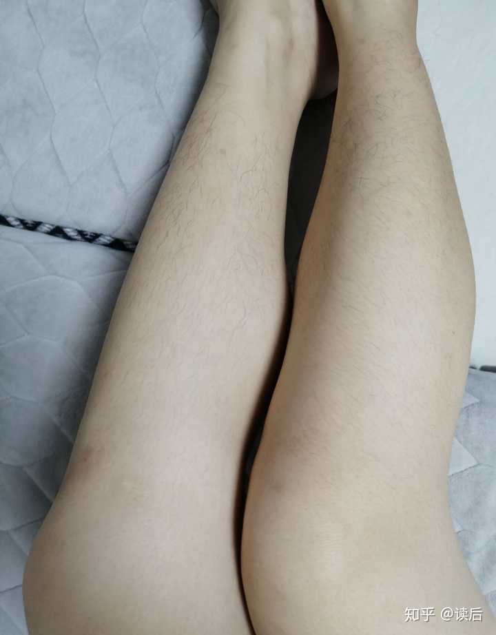 鸡皮肤上腿毛穿短裤(鸡皮肤多穿短裤会不会好)