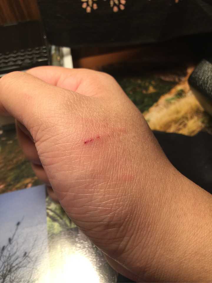 被自养的猫咬破手流了点血,要打狂犬病疫苗吗?