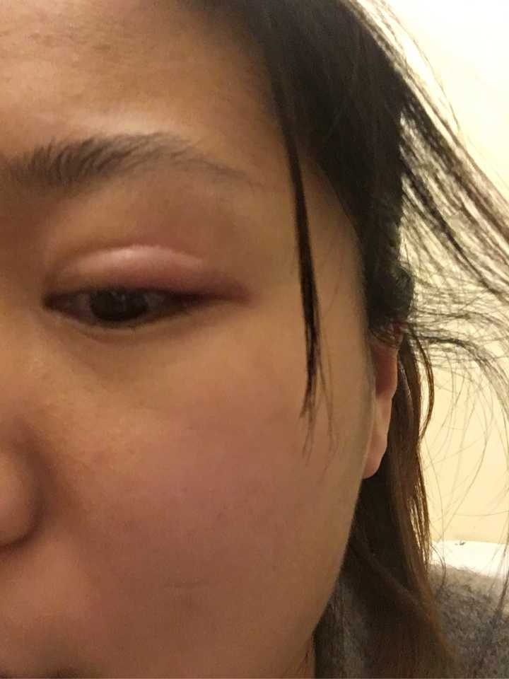 什么牌子的眼影会过敏?