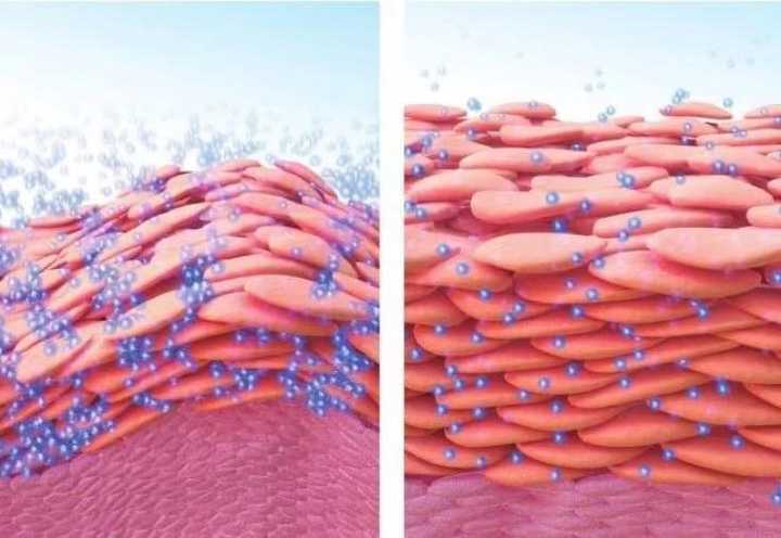 (图中被充盈的是角质层细胞,这就是你们贴完面膜的亚子!