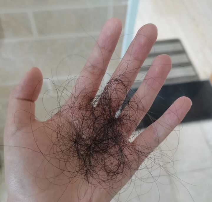 头部脂溢性皮炎,求推荐的洗发水,很多洗发水都过敏? - 知乎