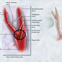 但是在脖子上种草莓可能是致命的,尤其有颈动脉窦综合征的人群