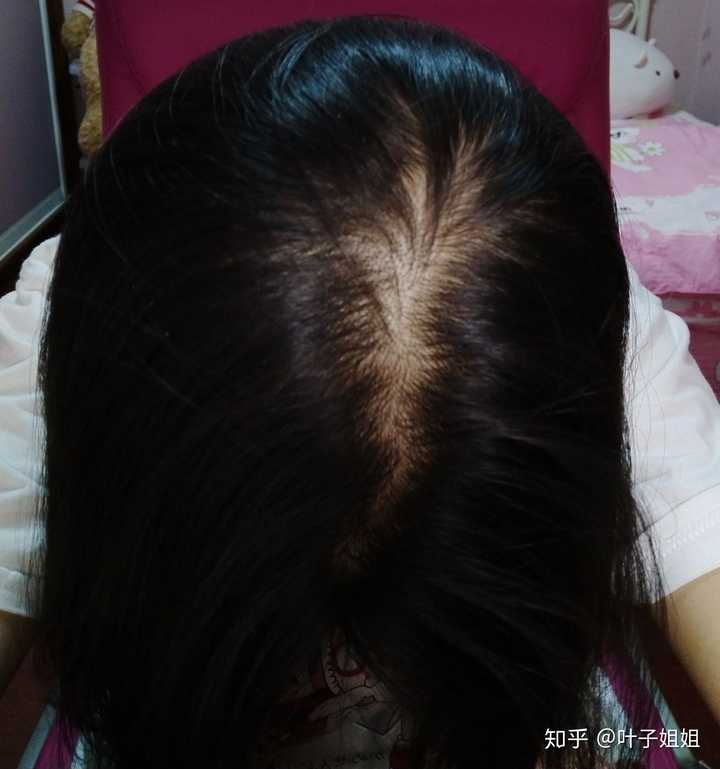 女生头发少是一种怎样的体验?