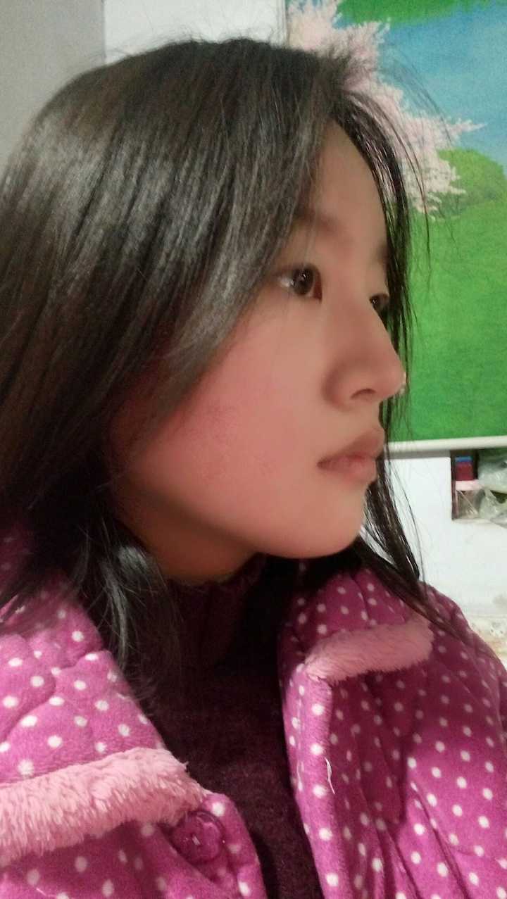 侧脸丑到不知道怎么整?