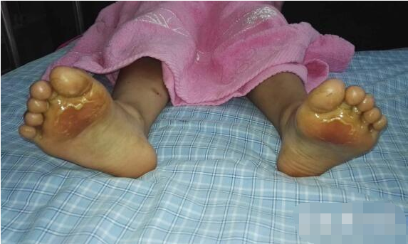 小学生因未穿运动鞋被罚光脚跑步