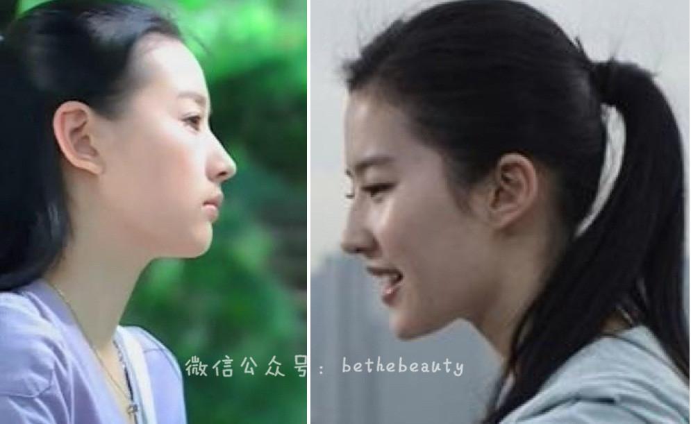 为什么有的人正面好看 有的人侧面好看 知乎
