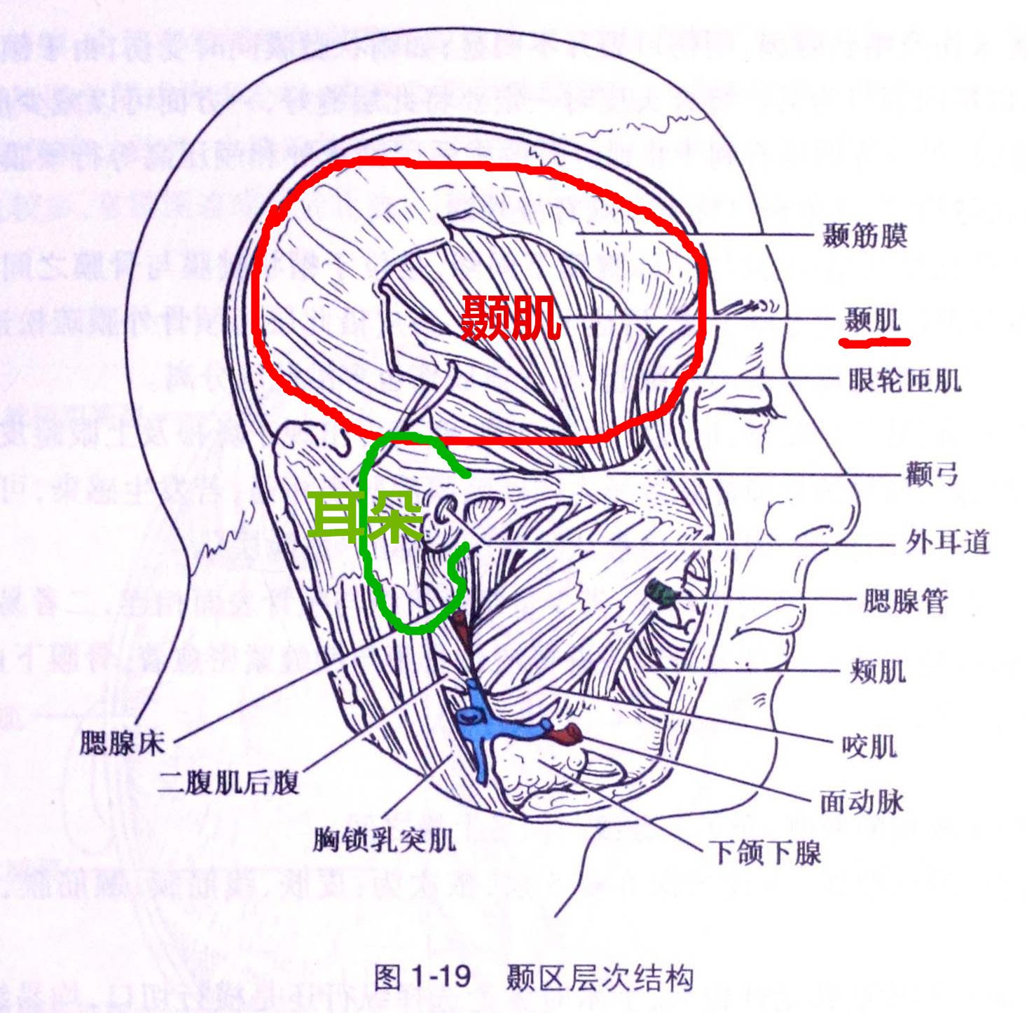 图中已经画出来了,那个红色圈圈的地方是颞肌,为了方便大家定位,下面