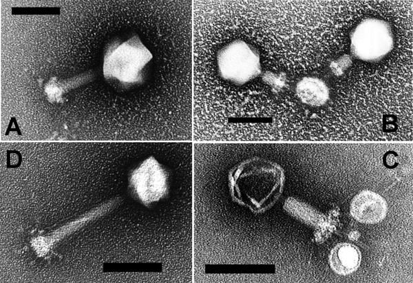 噬菌体显微镜下图片图片