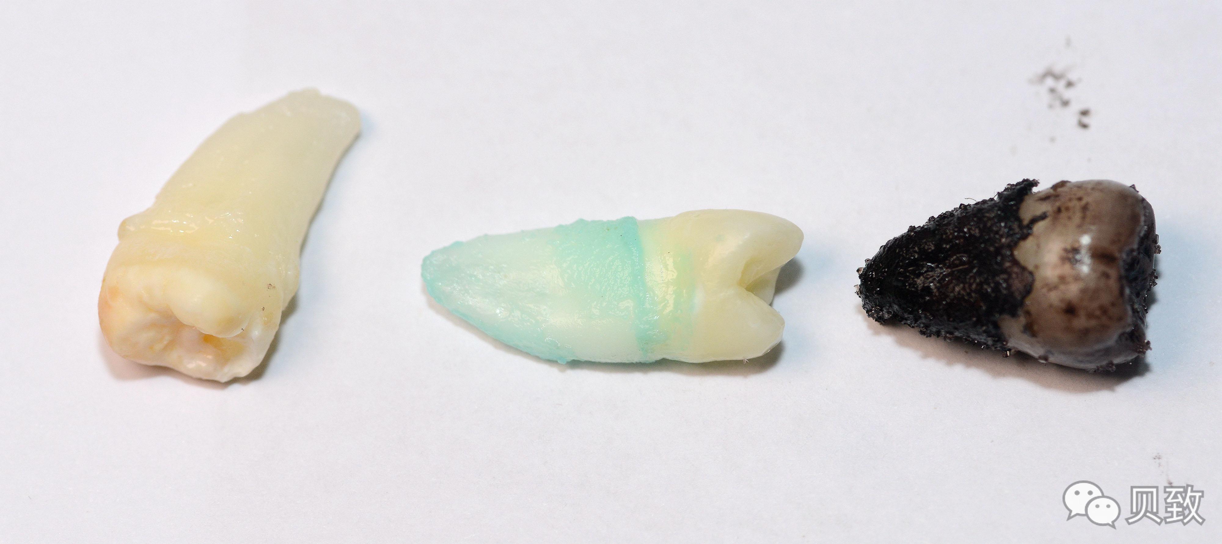 (转)谁能想到,饮料正在“谋杀”我们的牙齿 (转)谁能想到,饮料正在“谋杀”我们的牙齿